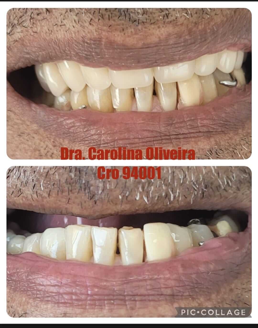 dentista+em+santana+zona+norte+sp