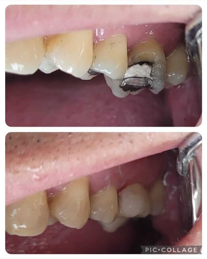 dentista+em+santana+zona+norte+sp(1)