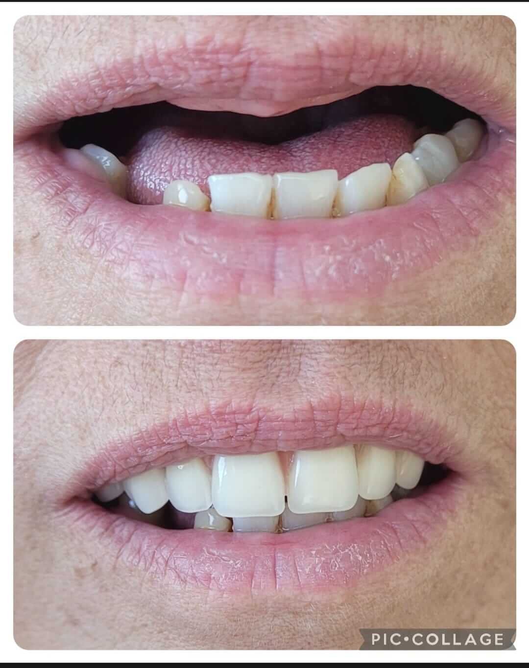 dentista+em+santana+zona+norte+sp(2)