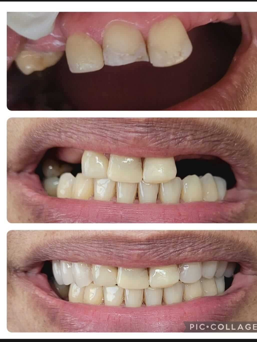 dentista+santana+sp