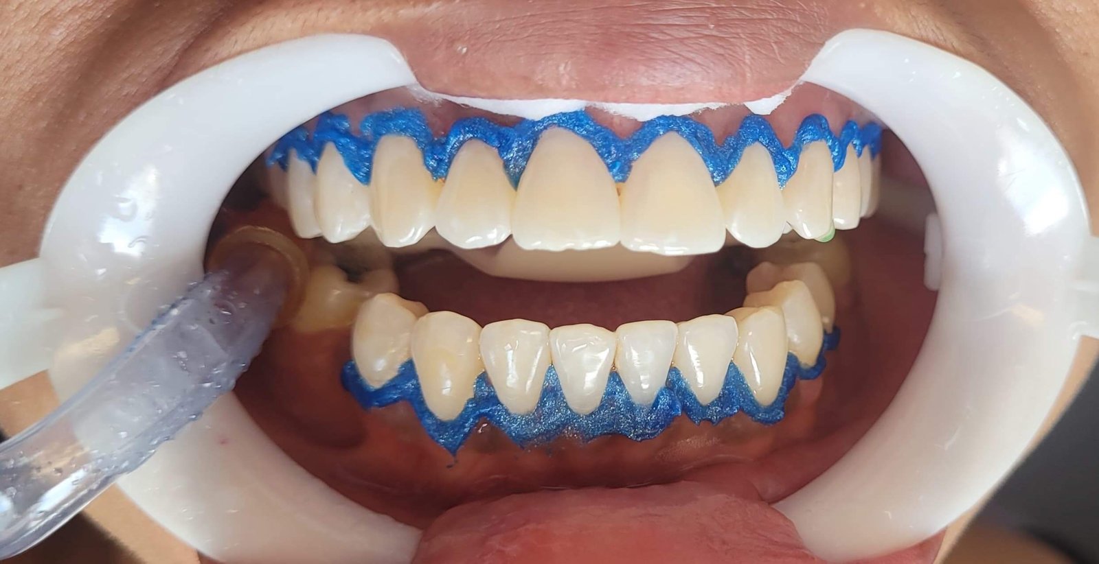 dentista+zona+norte+sp(1)