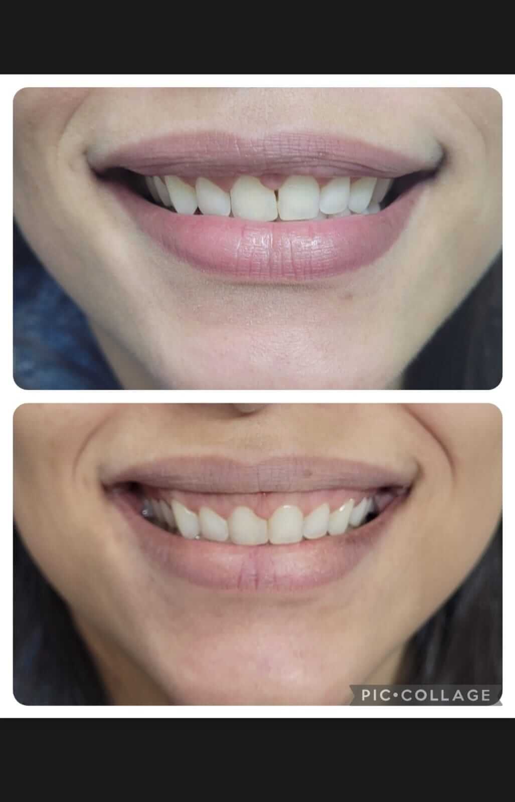 implantodontia+santana+zona+norte