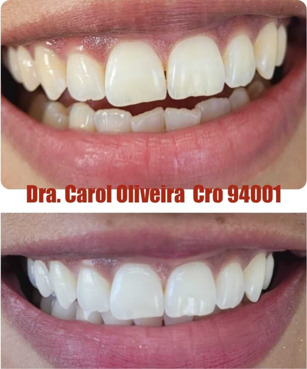 implantodontia+santana+zona+norte(2)