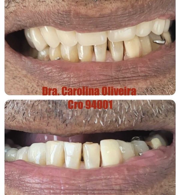 dentista+em+santana+zona+norte+sp