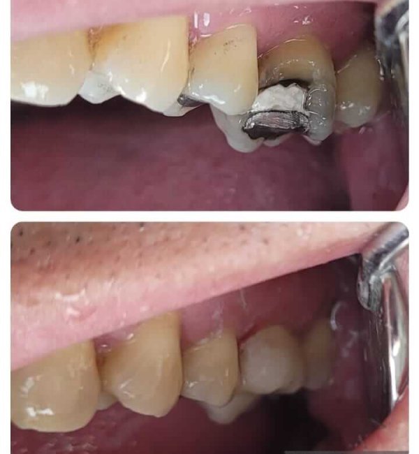 dentista+em+santana+zona+norte+sp(1)