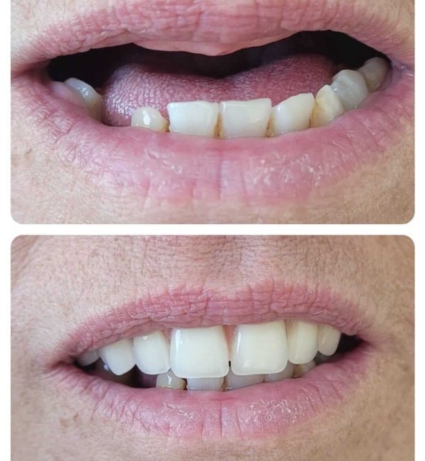 dentista+em+santana+zona+norte+sp(2)