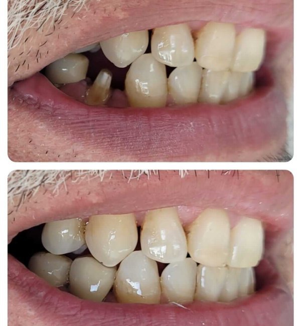 dentista+zona+norte+sp(2)