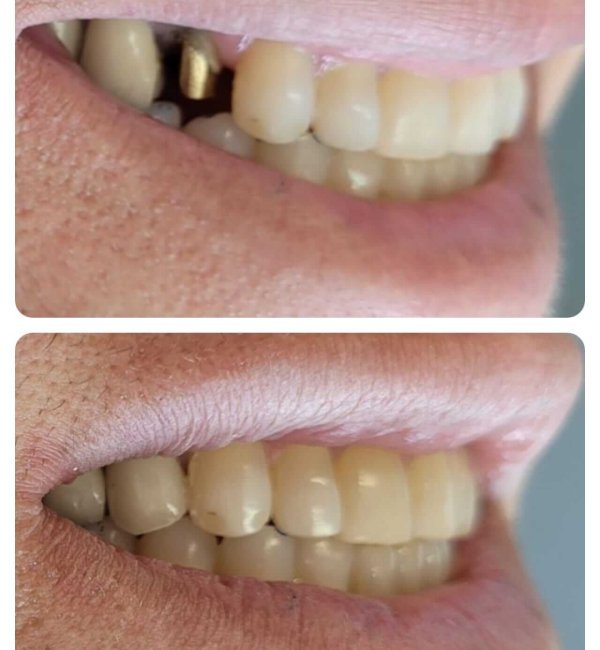 dentista+zona+norte+sp(3)