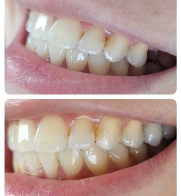 dentista+zona+norte+sp(4)