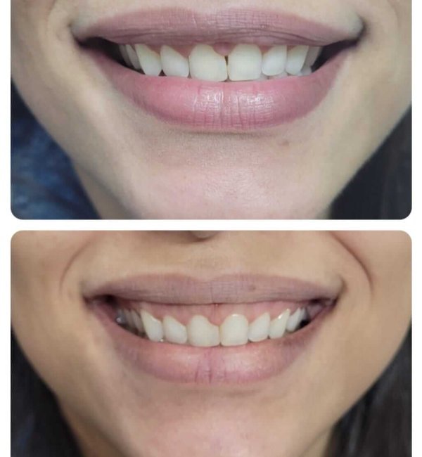 implantodontia+santana+zona+norte